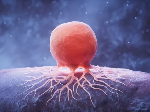 Thứ khiến chúng ta hạnh phúc có thể liên quan đến bệnh ung thư