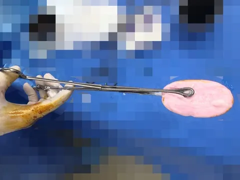 Bé gái đi cấp cứu vì nhét xà phòng vào vùng kín lúc đang tắm