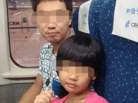 Bố đưa con gái về quê nghỉ Tết, đứa trẻ liên tục khóc, ai cũng hoảng sợ khi nhìn bàn tay người đàn ông