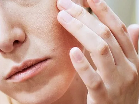 Làm sao để giảm khô ngứa da vào mùa lạnh?