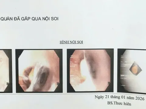 Bác sĩ cảnh báo một tai nạn nguy hiểm dễ gặp ở người già