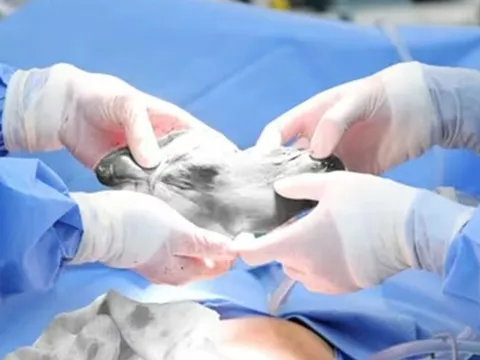 Đau bụng kéo dài, người phụ nữ đi khám phát hiện bí mật đáng sợ