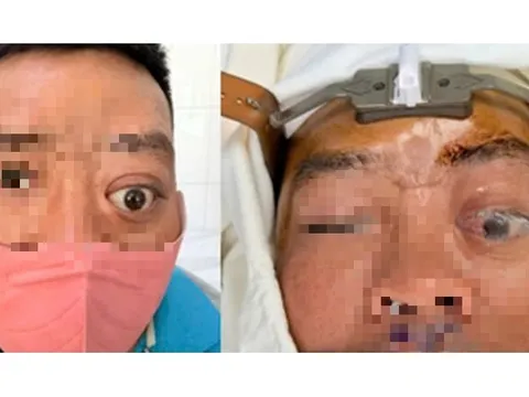 Một ca bệnh mà Bệnh viện Tai Mũi Họng TPHCM mới gặp lại trong vòng 20 năm