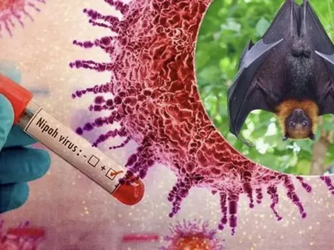 Sở Tp.HCM thông tin về tình hình, phương án phòng chống bệnh do virus Nipah