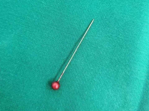 Giành lại sự sống cho bé 13 tháng tuổi mắc kim ghim trong phế quản