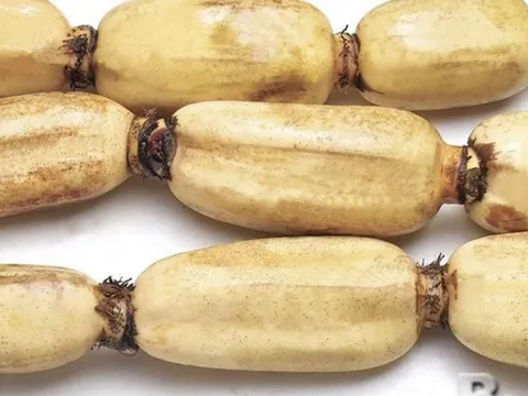 2 loại củ dễ là “ổ ký sinh trùng" mắt thường không thấy được, loại đầu bảng nhiều người mê