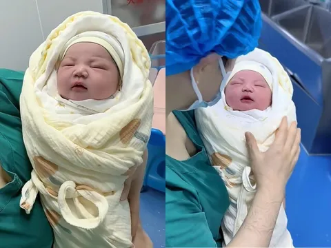 Bé sơ sinh chào đời khiến phòng mổ bệnh viện náo loạn vì như búp bê, bác sĩ ra lệnh liền biết làm theo