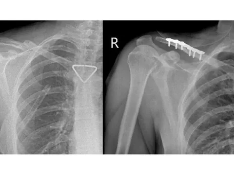 Thêm 1 du khách người Nga được bác sĩ cấp cứu kịp thời