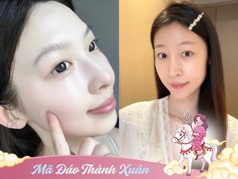 3 phương pháp làm đẹp hứa hẹn "làm mưa làm gió" năm 2026, chị em áp dụng là trẻ hoá diện mạo hơn hẳn