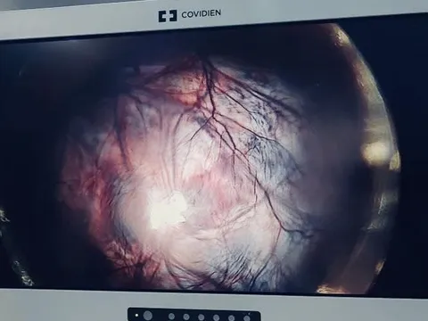 Giữ lại thiên chức làm mẹ cho bệnh nhân 22 tuổi