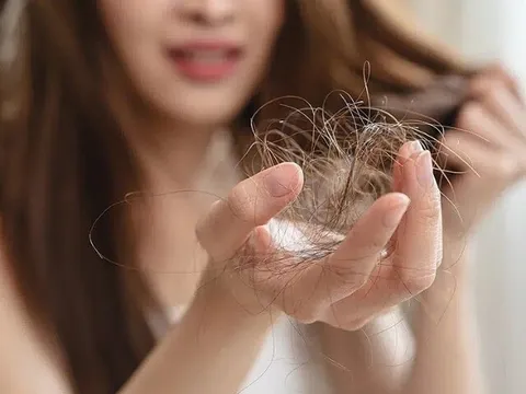 4 nguyên nhân phổ biến khiến vuốt nhẹ tóc cũng rụng cả nắm