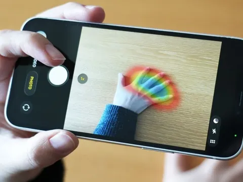 Chụp ảnh bàn tay, phát hiện được bệnh hiếm gặp