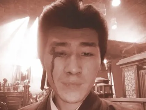 Diễn viên tố đoàn phim bỏ mặc sau tai nạn phải khâu 6 mũi