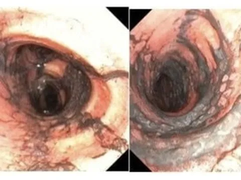 Ngạt khói nặng sau vụ cháy, đôi vợ chồng trẻ được hồi phục kỳ diệu