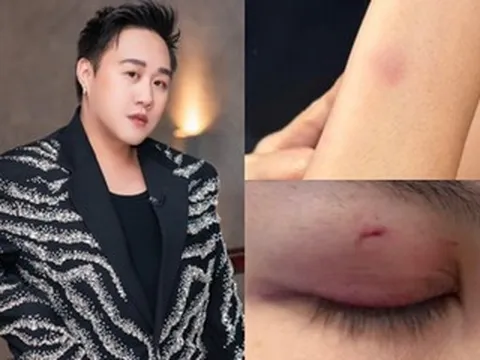 5 vụ sao Việt đánh người: Người thừa nhận say rượu, kẻ bị tát giữa phim trường