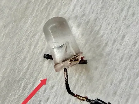 Bé 9 tháng tuổi ho nhiều ngày, bố mẹ "sốc" khi bác sĩ gắp ra đèn LED nằm trong phế quản