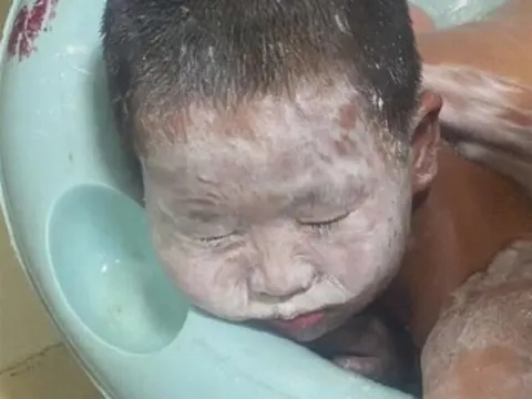Mẹ phát hiện con trai đi tắm mãi vẫn chưa ra, vào kiểm tra thì hoảng hốt thấy mặt con trắng bệch