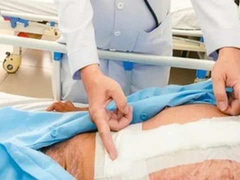 Cân não cứu người đàn ông thủng tim, từng bị bỏng nặng 60% cơ thể