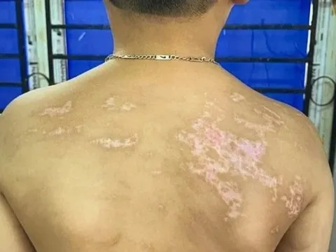 Tuần 4 trẻ bị bạo hành, chớ coi tiếng khóc là việc nhà người ta