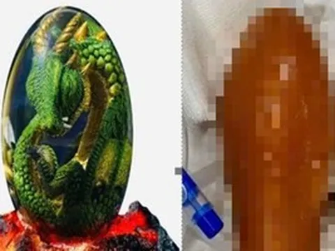 Người đàn ông nhập viện sau khi sử dụng đồ chơi tình dục “Trứng Rồng”