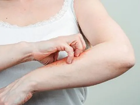 Luôn cảm thấy ngứa, người phụ nữ 59 tuổi "sốc" khi biết mình mắc liền 2 căn bệnh nguy hiểm này