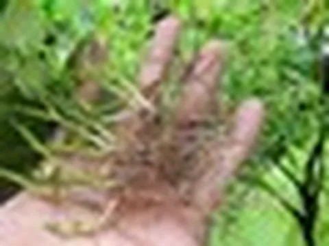 Uống lá đinh lăng, rễ lá lốt, người đàn ông cấp cứu vì không thể đi lại