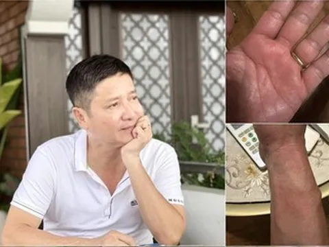 NSƯT Chí Trung mắc bệnh lạ, mất ngủ triền miên