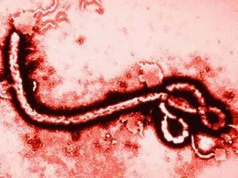 WHO nâng mức cảnh báo dịch Ebola lên khẩn cấp, Bộ Y tế lên tiếng
