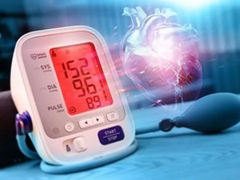Phát hiện nguyên nhân mới làm tăng nguy cơ bị cao huyết áp, đột quỵ