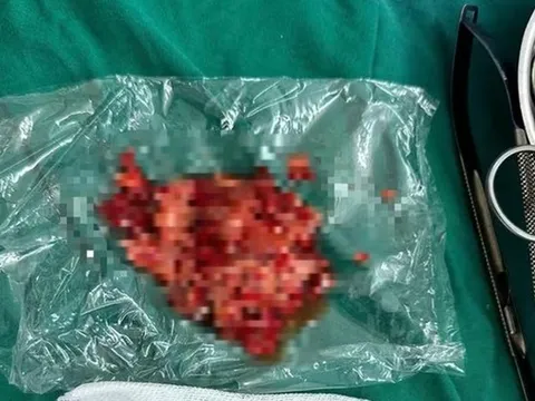 Bé trai 13 tuổi nguy kịch vì mải miết ăn uống theo cách "lạ đời"