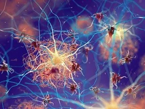 Phát hiện "điểm lật" quyết định ai sẽ mất trí nhớ khi về già