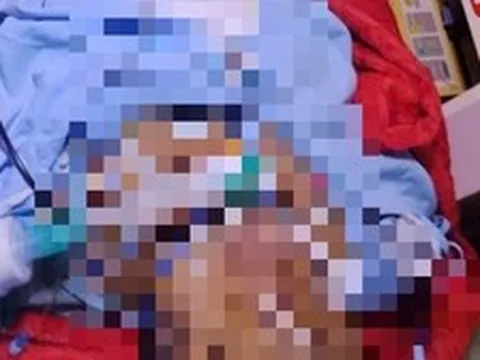 Bị bỏng nặng, mẹ đợi con thi xong tốt nghiệp THPT mới yên lòng nhắm mắt