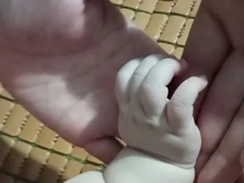 Người đàn ông hiếm muộn do Klinefelter làm cha sau 7 năm