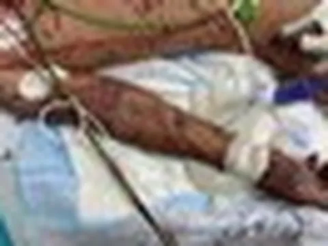 Bác sĩ Bệnh viện Nhi đồng TP.HCM đau lòng kể bé trai 10 tuổi tử vong chỉ sau 1 ngày đau đầu: Cảnh báo căn bệnh diễn tiến rất nhanh phụ huynh ám ảnh