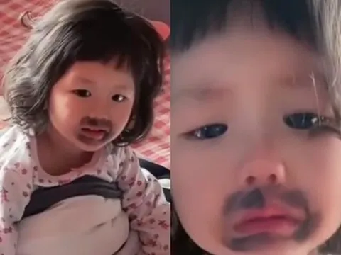 Ngủ dậy thấy miệng mọc vết bầm đen, bé gái khóc thét, mẹ phát hiện nguyên nhân từ món con ăn mỗi ngày