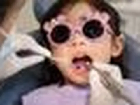 Đưa con chữa răng ở Mỹ hết hơn 100 triệu, về Việt Nam chưa đến 4 triệu đồng
