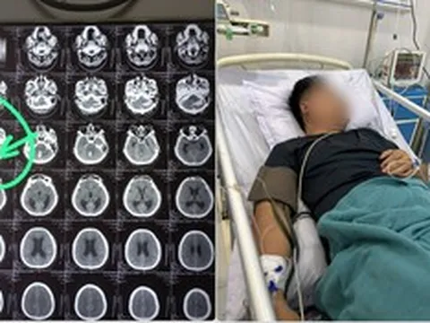 Người vợ quyết đưa chồng vượt 1.000km về Việt Nam giành lại sự sống