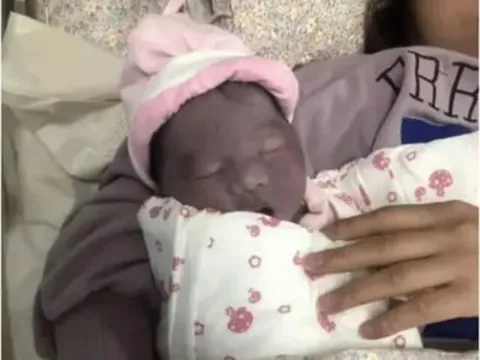 Con vừa chào đời đã có làn da tím khác thường, bố mẹ lo lắng, nào ngờ 2 tháng sau nhận không ra con