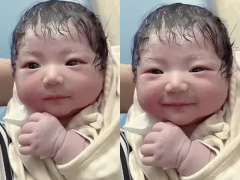Bé sơ sinh chào đời đẹp như búp bê khiến cõi mạng xôn xao, y tá nói: “Đứa trẻ đã phẫu thuật thẩm mỹ”