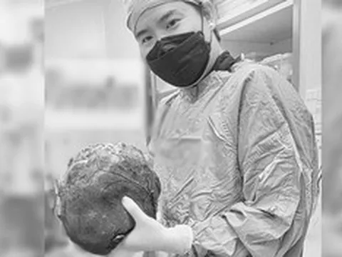 Bác sĩ sững người trước "thứ đáng sợ" trong bụng bệnh nhân