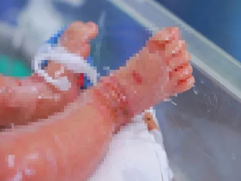Bé trai sinh non mắc bệnh vảy cá hiếm gặp