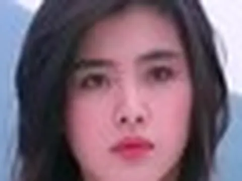Biểu tượng nhan sắc lên tiếng về gương mặt biến dạng