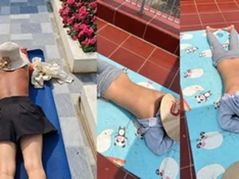 Cảnh báo nguy cơ sức khỏe từ trào lưu "phơi nắng giữa trưa"