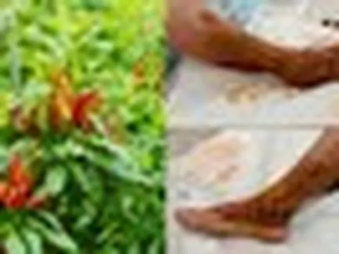 Bác sĩ giã lá ớt đắp vết thương khiến người phụ nữ 65 tuổi nhiễm trùng, hoại tử, nguy cơ mất chân